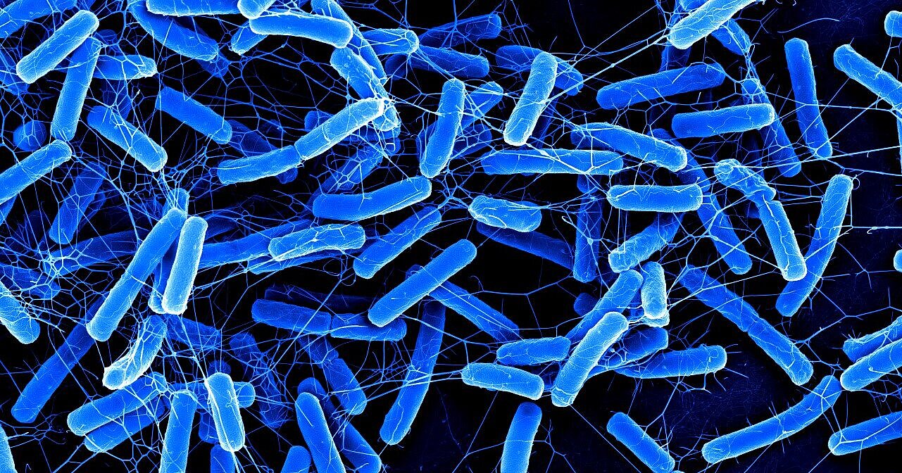 csm_hzi_wiss_clostridium_mr_005_c2e4172002 csm_hzi_wiss_clostridium_mr_005_c2e4172002