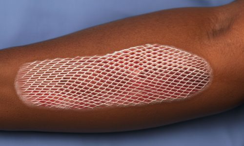 aeb76861-fbc0-4fbc-b8f5-b78fc9c92c8c-(1)