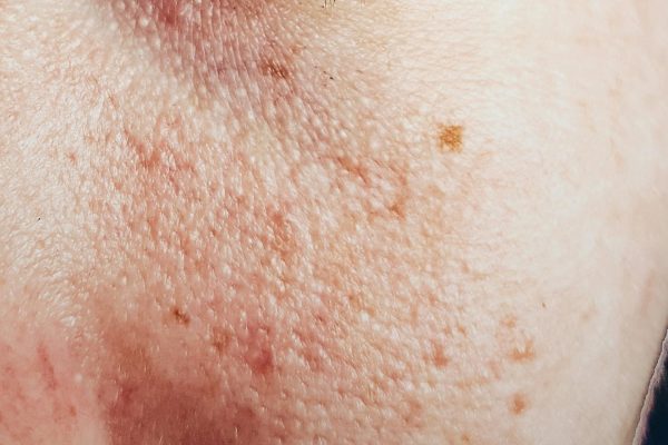 pexels-almadastudio-609549