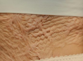 pexels-ron-lach-8626312